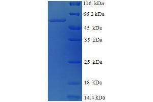 SDS-PAGE (SDS) image for Tyrosinase (TYR) (AA 19-377), (partial) protein (His-SUMO Tag) (ABIN5710578) (TYR Protein (AA 19-377, partial) (His-SUMO Tag))