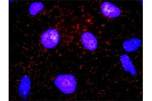Proximity Ligation Analysis of protein-protein interactions between CD19 and CD82. (CD19 antibody  (AA 1-556))