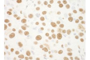 Immunohistochemistry (IHC) image for anti-Nucleophosmin (Nucleolar phosphoprotein B23, Numatrin) (NPM1) (AA 250-294) antibody (ABIN7448992) (NPM1 antibody  (AA 250-294))