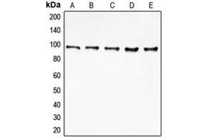 Western blot analysis of EIF4G2 expression in MCF7 (A), HeLa (B), K562 (C), Jurkat (D), HepG2 (E) whole cell lysates. (EIF4G2 antibody  (N-Term))