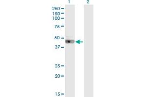 Western Blot analysis of LRRC2 expression in transfected 293T cell line by LRRC2 monoclonal antibody (M02), clone 1G3.