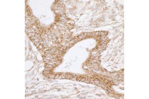 Immunohistochemistry (IHC) image for anti-TNF Receptor-Associated Protein 1 (TRAP1) (AA 50-100) antibody (ABIN7455062)
