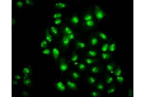 Immunofluorescence staining of Hela cells with ABIN7172427 at 1:200, counter-stained with DAPI. (TCEA3 antibody  (AA 79-169))