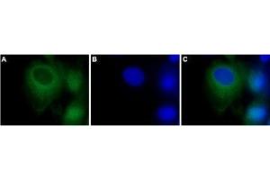 Expression of TRPC3 in rat C6 brain glioma cells - Immunocytochemical staining of Paraformaldehyde-fixed and permeabilized rat C6 brain glioma cells. (TRPC3 antibody  (C-Term, Intracellular))