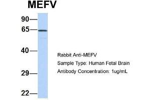 Host:  Rabbit  Target Name:  MEFV  Sample Type:  Human Fetal Brain  Antibody Dilution:  1. (MEFV antibody  (N-Term))