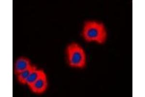 Immunofluorescent analysis of IRAK3 staining in LOVO cells. (IRAK3 antibody  (C-Term))