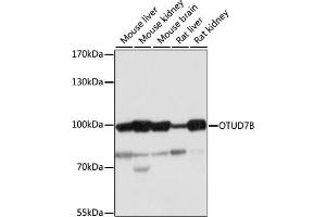 Western blot analysis of extracts of various cell lines, using OTUD7B antibody (ABIN7269125) at 1:1000 dilution.