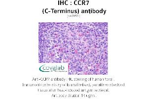 Image no. 2 for anti-Chemokine (C-C Motif) Receptor 7 (CCR7) (C-Term) antibody (ABIN1732781) (CCR7 antibody  (C-Term))