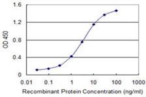 Detection limit for recombinant GST tagged RCBTB1 is 0. (RCBTB1 antibody  (AA 2-90))