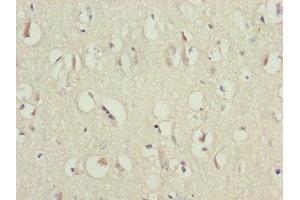 Immunohistochemistry of paraffin-embedded human brain tissue using ABIN7146448 at dilution of 1:100 (CAMK2D antibody  (AA 1-260))