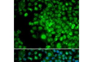 Immunofluorescence analysis of HeLa cells using FHL1 Polyclonal Antibody (FHL1 antibody)