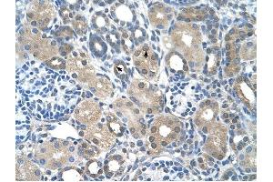 FBXO25 antibody was used for immunohistochemistry at a concentration of 4-8 ug/ml to stain Epithelial cells of renal tubule (arrows) in Human Kidney. (FBXO25 antibody  (C-Term))