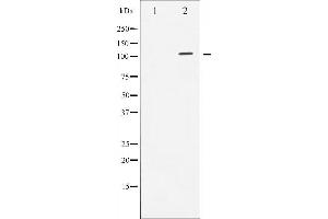 Western blot analysis of Androgen Receptor expression in LOVO whole cell lysates,The lane on the left is treated with the antigen-specific peptide.
