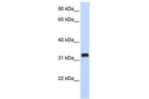 Image no. 1 for anti-Chromosome 21 Open Reading Frame 62 (C21orf62) (AA 108-157) antibody (ABIN6740939) (C21orf62 antibody  (AA 108-157))