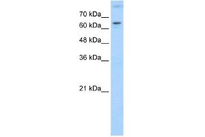 WB Suggested Anti-RORA Antibody Titration:  1. (RORA antibody  (N-Term))