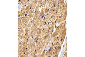 Immunohistochemical analysis of paraffin-embedded M. (FABP3 antibody  (AA 1-133))