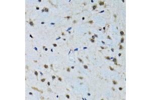 Immunohistochemistry of paraffin-embedded rat brain using IGF1 antibody (ABIN1873156) at dilution of 1:100 (40x lens). (IGF1 antibody)
