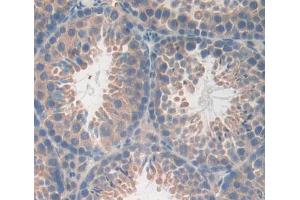 Used in DAB staining on fromalin fixed paraffin- embedded testis tissue (CA13 antibody  (AA 1-262))