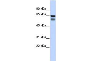 WB Suggested Anti-GALNT4 Antibody Titration:  0.