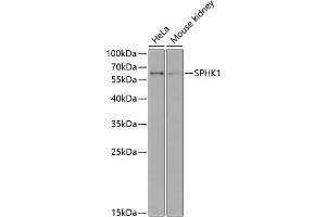 Western blot analysis of extracts of various cell lines, using SPHK1 antibody (ABIN6128745, ABIN6148344, ABIN6148345 and ABIN6213923) at 1:1000 dilution. (SPHK1 antibody  (AA 50-384))