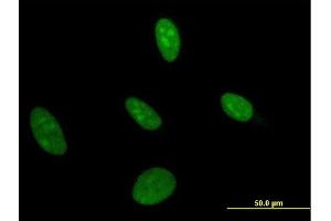 Immunofluorescence (IF) image for anti-Uridine Monophosphate Synthetase (UMPS) (AA 381-479) antibody (ABIN521259)