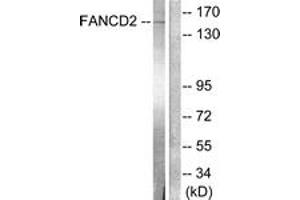 Western blot analysis of extracts from HT-29 cells, treated with Calyculin A 50ng/ml 30', using FANCD2 (Ab-222) Antibody. (FANCD2 antibody  (AA 188-237))