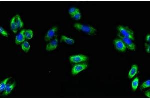 Immunofluorescent analysis of HepG2 cells using ABIN7170424 at dilution of 1:100 and Alexa Fluor 488-congugated AffiniPure Goat Anti-Rabbit IgG(H+L) (SPG11 antibody  (AA 2019-2318))