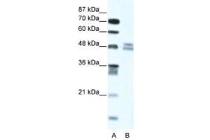 WB Suggested Anti-TRIP13  Antibody Titration: 5. (TRIP13 antibody  (N-Term))