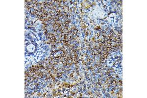 Immunohistochemistry (IHC) image for anti-Apolipoprotein B mRNA Editing Enzyme, Catalytic Polypeptide-Like 3G (APOBEC3G) (AA 60-330) antibody (ABIN6137010)