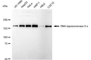 Western blotting analysis using DNA topoisomerase II alpha antibody (ABIN7800574). (Recombinant Topoisomerase II alpha antibody)