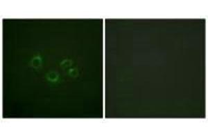 Immunofluorescence analysis of A549 cells, using EPHA2/3/4 (Ab-588/596) antibody. (EPH Receptor A2 antibody  (Tyr588, Tyr596))