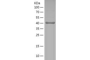 Western Blotting (WB) image for Discs, Large Homolog 4 (Drosophila) (DLG4) (AA 9-121) protein (His-IF2DI Tag) (ABIN7282745) (DLG4 Protein (AA 9-121) (His-IF2DI Tag))
