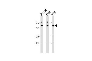 ACHE Antibody (N-term) (ABIN392325 and ABIN2841973) western blot analysis in Jurkat,Raji,Y79 cell line lysates (35 μg/lane).