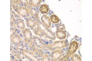 Immunohistochemistry of paraffin-embedded Rat kidney using PIP4K2A Polyclonal Antibody at dilution of 1:100 (40x lens). (PIP4K2A antibody)