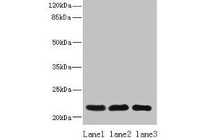 Western blot All lanes: SSR3 antibody at 10 μg/mL Lane 1: Hela whole cell lysate Lane 2: U87 whole cell lysate Lane 3: A431 whole cell lysate Secondary Goat polyclonal to rabbit IgG at 1/10000 dilution Predicted band size: 22, 23 kDa Observed band size: 22 kDa (SSR3 antibody  (AA 77-135))