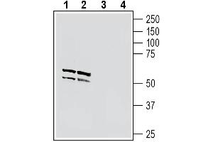 Neuronal Pentraxin 1 (NPX1) peptide