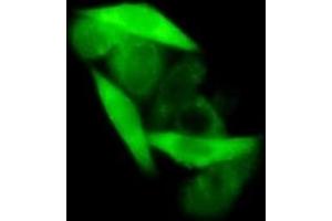 Detection of GAPDH in MCF7 cells using Polyclonal Antibody to Glyceraldehyde-3-Phosphate Dehydrogenase (GAPDH) (GAPDH antibody  (AA 2-148))