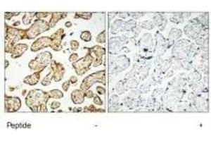 Immunohistochemistry analysis of paraffin-embedded human placenta tissue, using GNE antibody. (GNE antibody  (C-Term))