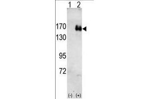 Western blot analysis of HER2(arrow) using rabbit polyclonal HER2 antibody. (ErbB2/Her2 antibody)