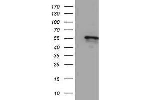 HEK293T cells were transfected with the pCMV6-ENTRY control (Left lane) or pCMV6-ENTRY CYP2A6 (Right lane) cDNA for 48 hrs and lysed. (CYP2A6 antibody)