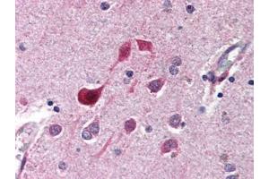 anti-CDK5 antibody  was diluted 1:500 to detect CDK5 in human brain cortex tissue. (CDK5 antibody)