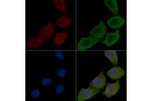 ABIN6257628 and ABIN6274171 staining Hela cells(30 min of UV treatment) by IF/ICC. (PRKCSH antibody  (Internal Region))