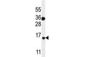 S100A1 antibody western blot analysis in MDA-MB435 lysate. (S100A1 antibody  (AA 45-75))
