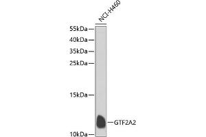 Western blot analysis of extracts of NCI-H460 cells, using GTF2 antibody  at 1:1000 dilution.
