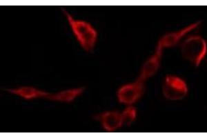 ABIN6269090 staining HepG2 by IF/ICC. (Integrin beta 3 antibody  (C-Term))