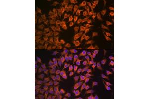 Immunofluorescence analysis of HeLa cells using CYP17 Rabbit mAb (ABIN7266648) at dilution of 1:100 (40x lens). (CYP17A1 antibody)