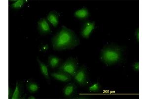 Immunofluorescence of monoclonal antibody to CDR2 on HeLa cell. (CDR2 antibody  (AA 296-404))