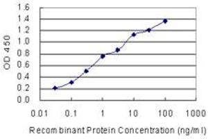 Detection limit for recombinant GST tagged SSX1 is 0. (SSX1 antibody  (AA 89-188))