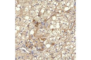 IHC analysis of RBMS1 using anti-RBMS1 antibody (ABIN7601195).