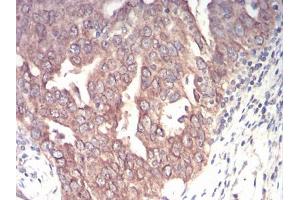 Immunohistochemistry (IHC) image for anti-Emerin (EMD) (AA 1-222) antibody (ABIN5542309)